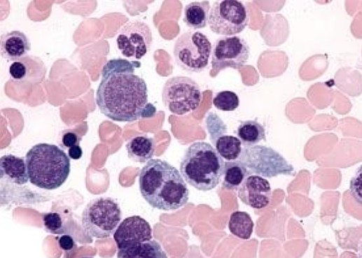 Molecular and cellular pathways of aging in hematopoiesis